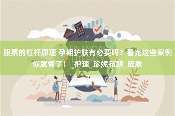 股票的杠杆原理 孕期护肤有必要吗？看完这些案例你就懂了！_护理_珍妮布朗_皮肤